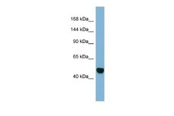 MAML3 Rabbit anti-Human, Polyclonal, Novus Biologicals 100 &mu;g | Buy Online | Novus Biologicals | Fisher Scientific